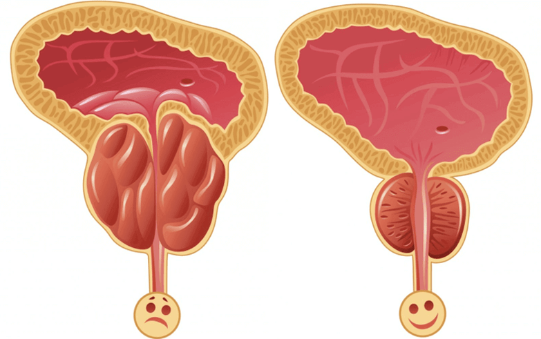 Причины проблем с потенцией у мужчин